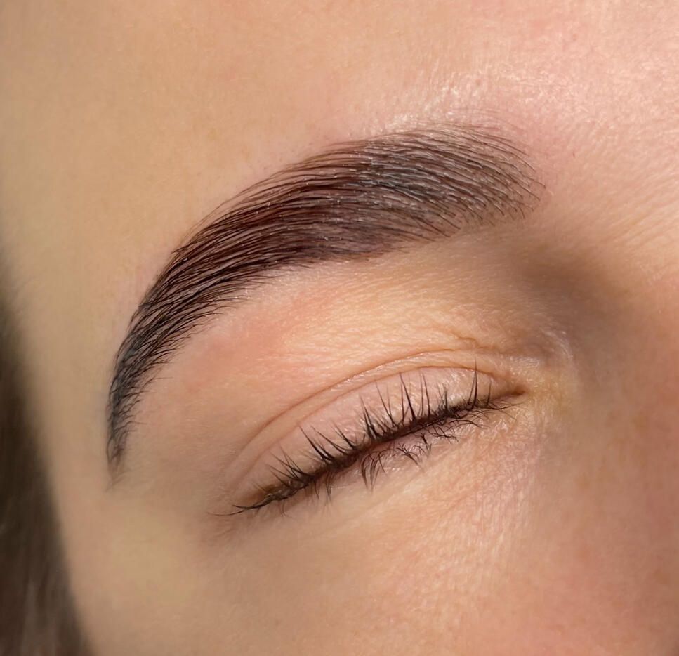 Brow Lifting